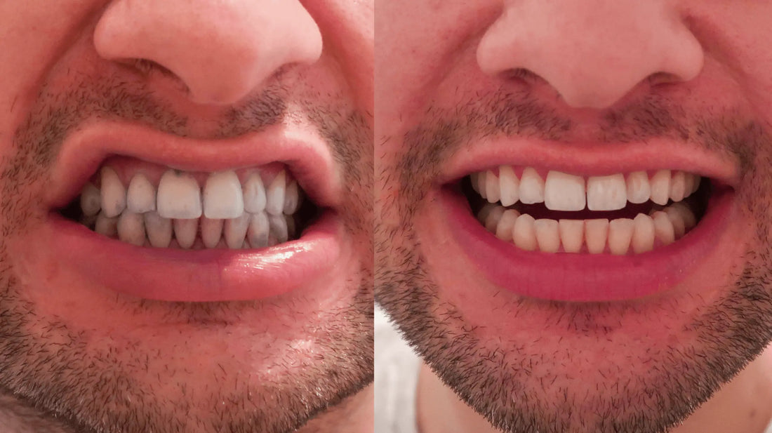 Dental Duty Review Electric Toothbrush Review &amp; Manual Vs Electric Toothbrush Experiment - Nick DiRamio