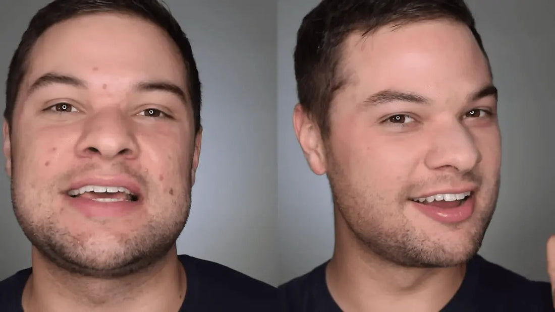 How To Cover a Pimple With Makeup for Men and Women - Natural Looking Acne Coverage (No Foundation) - Nick DiRamio